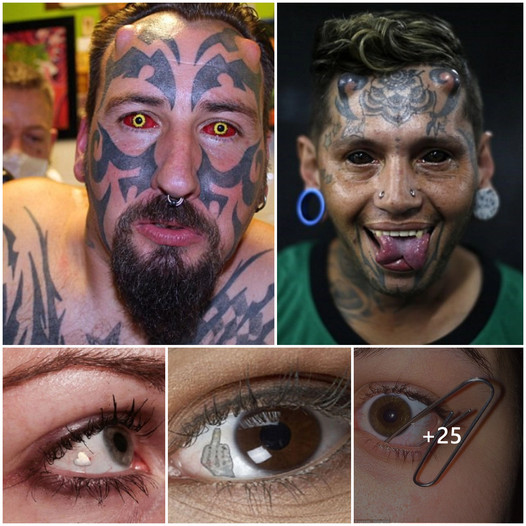 Tattooing irises, inserting needles, keychains… to beautify the eyes