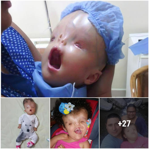 Unwavering Love: The Heartwarming Journey of a Baby Girl’s Story Beyond Imperfections ‎